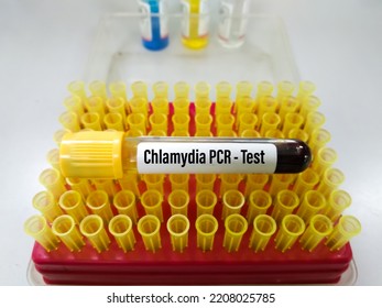 Chlamydia PCR Blood Test Or Polymerase Chain Reaction For Chlamydia To Detect STD