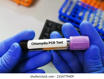 Chlamydia PCR Test Or  Polymerase Chain Reaction For Chlamydia To Detect STD