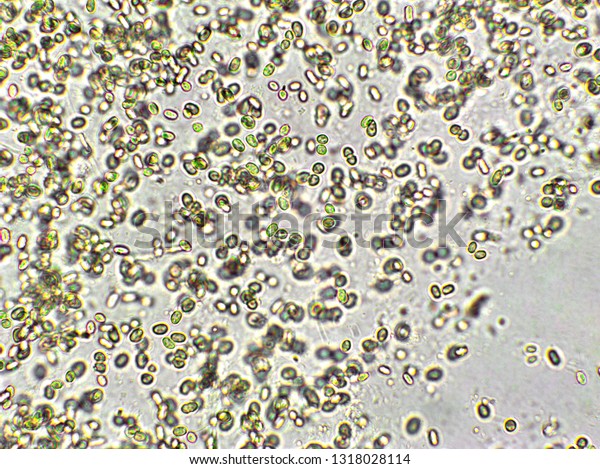 Chlorella Vulgaris Algae Under Microscopic View Stock Photo (Edit Now ...
