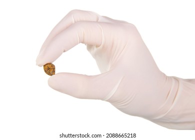 Cholelithiasis (gallbladder stone) after successful operation in the hands of a surgeon isolated on white background