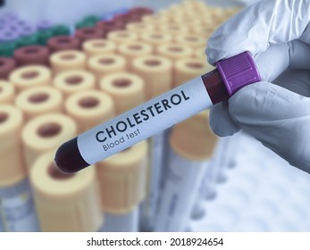 Cholesterol Blood Test Tube Held By Laboratory Researcher Hand Lipid Tests