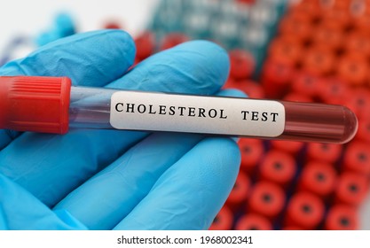 Cholesterol Test Result With Blood Sample In Test Tube On Doctor Hand  In Medical Lab