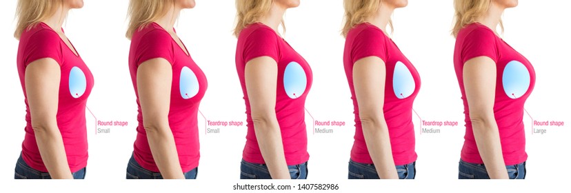 Choosing the right size of breast implants for desired look