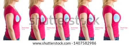 Choosing the right size of breast implants for desired look