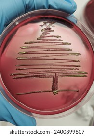 Christmas tree pattern of E.coli growing on eosin methylene blue (EMB) agar plate.