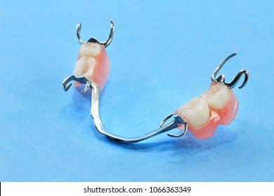 Chromium removable partial denture on blue background.