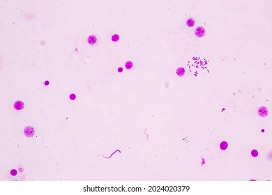 458 Human chromosomes under microscope Images, Stock Photos & Vectors ...