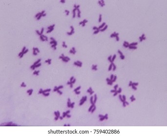 Chromosomes under the microscope - Shutterstock ID 759402886