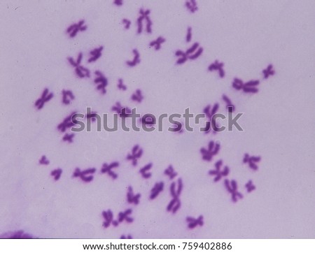 Chromosomes under the microscope