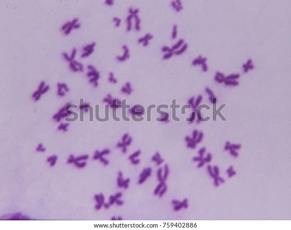 Chromosomes Under Microscope Stock Photo (Edit Now) 759402886
