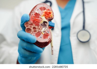 Chronic kidney disease, doctor holding model for treatment urinary system, urology, Estimated glomerular filtration rate eGFR. - Shutterstock ID 2281680735