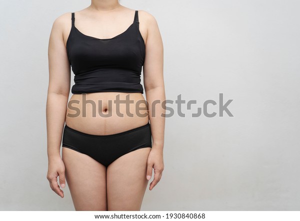 Chubby girl or fat young woman in bra  her stomach,
overweight or obesity on gray background. ,Beauty, shape, healthy
and health care female concept. MidSection Of  Woman With Excessive
Belly Fat