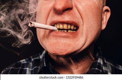 3,710 Cigarette and teeth Images, Stock Photos & Vectors | Shutterstock