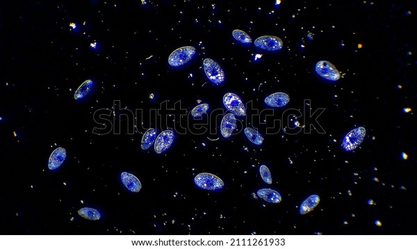 Cilia micro organisms\
floating in water