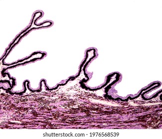 Ciliary body showing the typical folds or ciliary processes lined by a double epithelial layer, the non-pigmented inner epithelium and the pigmented epithelium resting on a highly vascularized stroma.