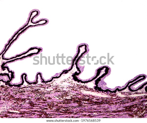Ciliary body showing the typical folds or ciliary
processes lined by a double epithelial layer, the non-pigmented
inner epithelium and the pigmented epithelium resting on a highly
vascularized stroma.