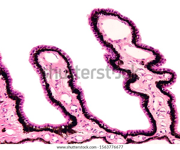Ciliary body showings the typical folds or ciliary\
processes lined by a double epithelial layer, the non-pigmented\
inner epithelium and the pigmented epithelium resting on a highly\
vascularized stroma
