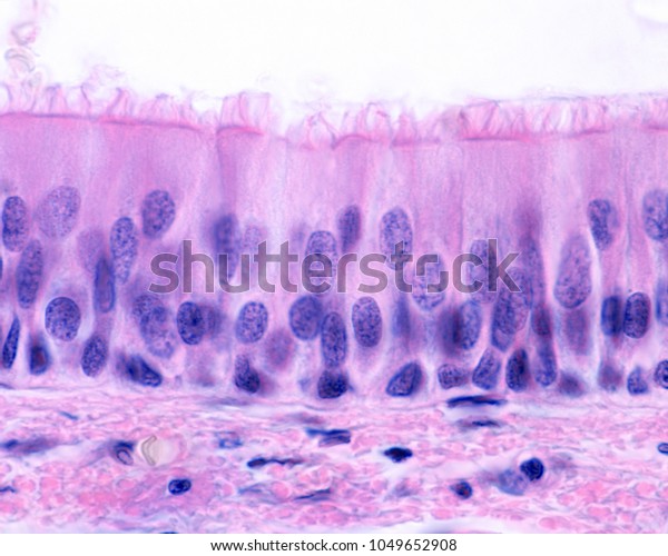 pseudostratified ciliated columnar epithelium