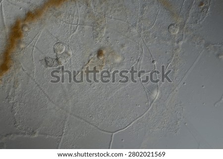 Ciliates in drops of water under the microscope 100x