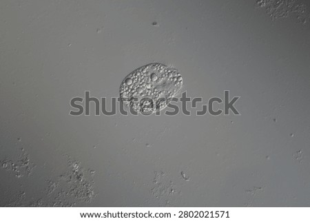 Ciliates in drops of water under the microscope 100x