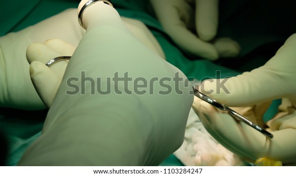 Circumcision Procedure Steps