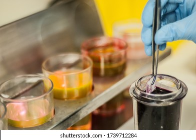 Citology Stain In Pathology Lab