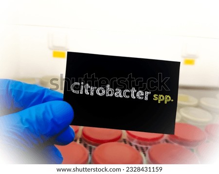 Citrobacter spp., medical and healthcare conceptual image. Gram Negative coliform bacteria in the family Enterobacteriaceae.