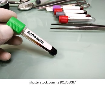 CJD Prion Disease. Human Mad Cow. Blood Sample For Laboratory Testing