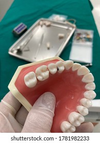 Class I And II Caries  And MOD Right Maxillary First Molar Preparation