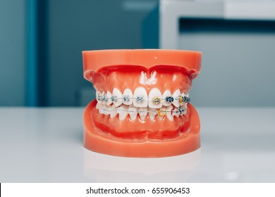 Dental Jaw Model Braces Brackets Stock Photo 581411413 | Shutterstock