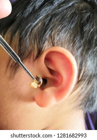 Cleaning A Child Ear Using Metal Earpick For Removing Wax