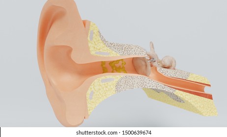 cleaning a dirty ear with cotton buds