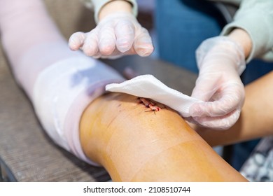 Cleaning and dressing incision and stitches after surgery - Shutterstock ID 2108510744