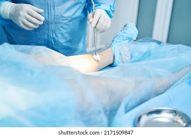 1,686 Surgical skin marking Images, Stock Photos & Vectors | Shutterstock