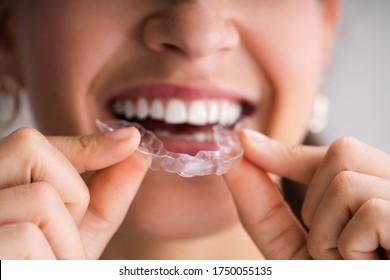Clear Aligner Dental Night Guard For Teeth