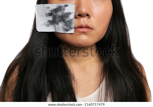 Clear Oil Sheet On Oily Skin Stock Photo Edit Now 1160717479