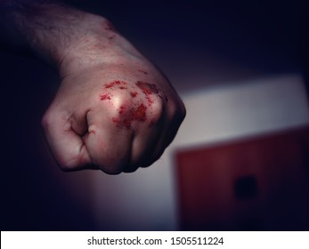 Clenched Left Hand Fist With Bloody And Bruised Knuckles Prepared To Punch Again. Domestic Violence, Abuse Or Family Violence Concept.