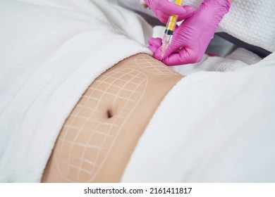 Client is receiving slimming body contouring procedure in aesthetic clinic