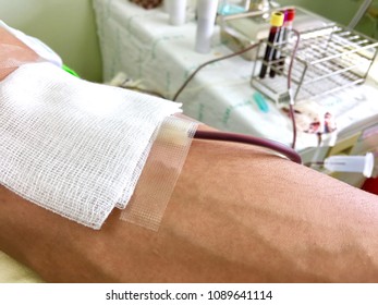 Cloes Up Hand A Man Giving Blood Cell Extraction In Lab.