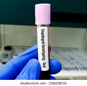 Clopidogrel PCR Genotyping Test. CYP2C19 Gene Testing. Polymerase Chain Reaction.