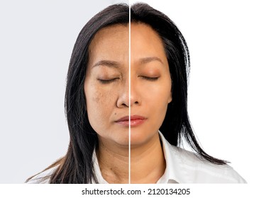 Close up aging asian woman 35-45 isolated on white background. Compare before and after beauty treatments result of skin care and face lifting to anti aging in woman facial. 