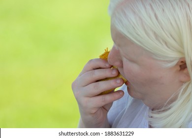 Close Up Of An Albino Woman Eating Taco Outdoors