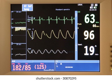 Close Anesthesia Monitor During Surgery Stock Photo 30870295 | Shutterstock