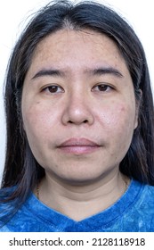 Close up of Asian adult woman face has freckles, large pores, blackhead pimple and scars problem from not take care for a long time. Soft focus of skin problem face. Treatment and Skincare concept - Shutterstock ID 2128118918
