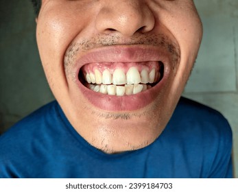 close up of asian man showing teeth - Powered by Shutterstock