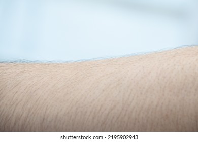 Close Up Of Asian Man Skin With Arm Hairy.(select Focus)