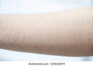 Close Up Of Asian Man Skin With Arm Hairy.(select Focus)