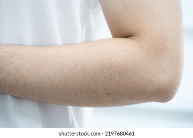 Close Up Of Asian Man Skin With Arm Hairy.(select Focus)