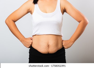 Close Up Of Asian Mother Woman Showing Stretch Mark Loose Lower Abdomen Skin She Fat After Pregnancy Baby Birth, Studio Isolated On White Background, Healthy Belly Overweight Excess Body Concept