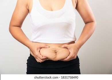 Close Up Of Asian Mother Woman Showing Stretch Mark Loose Lower Abdomen Skin She Fat After Pregnancy Baby Birth, Studio Isolated On White Background, Healthy Belly Overweight Excess Body Concept